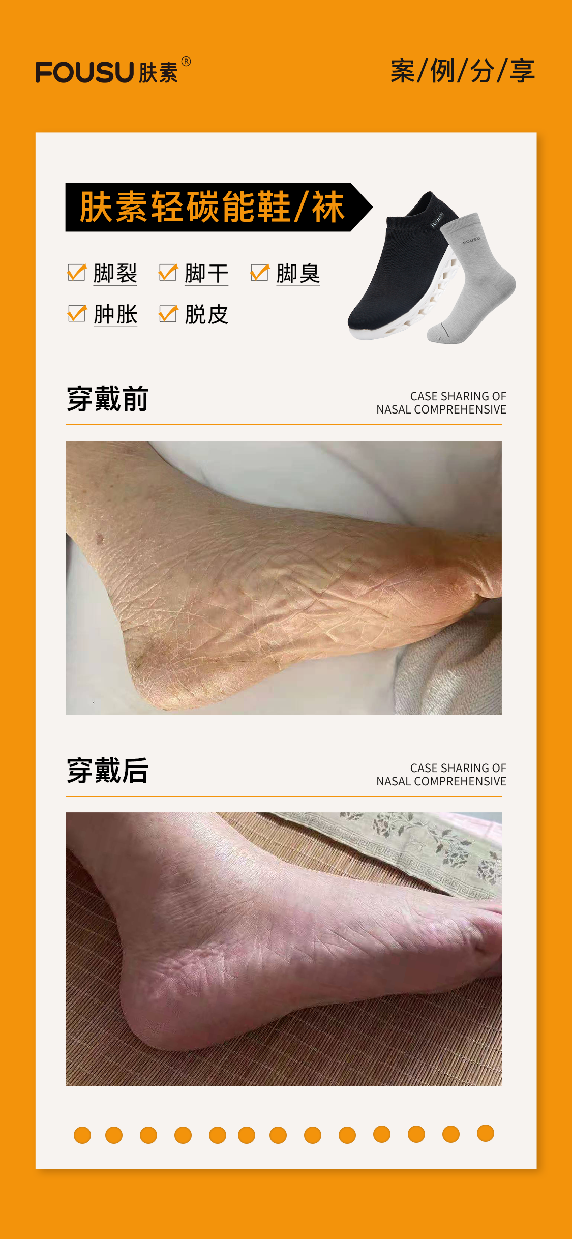 肤素轻碳能养生袜案例1