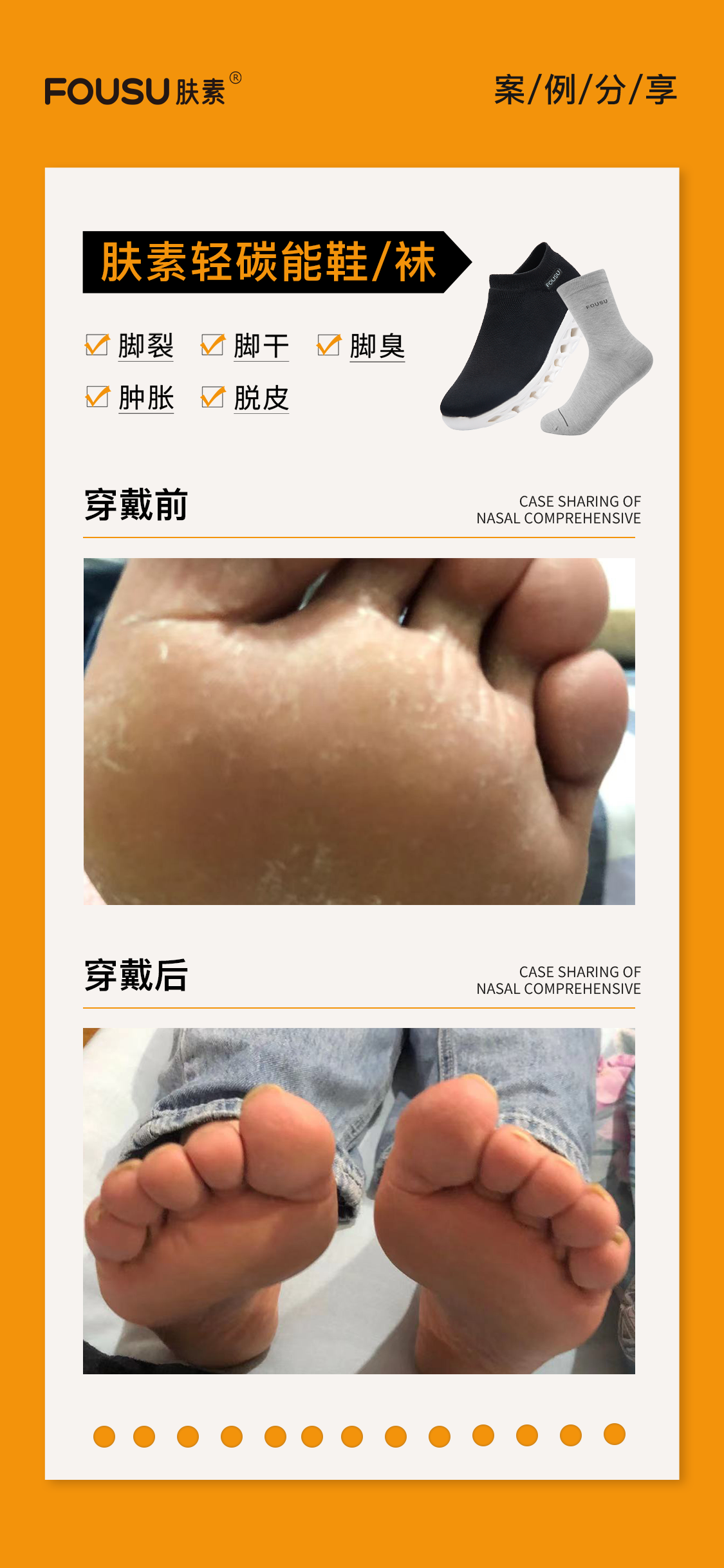 肤素轻碳能养生袜案例2