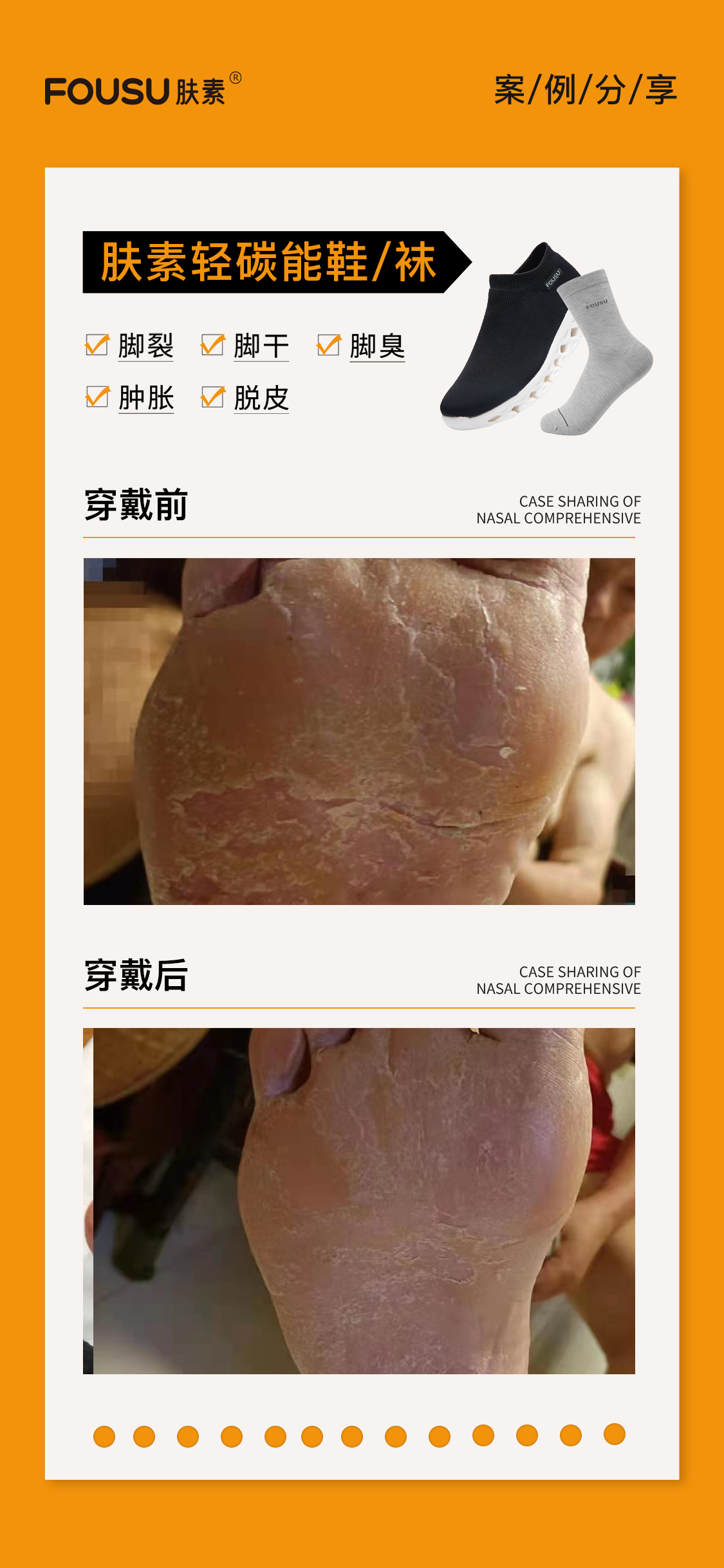 肤素轻碳能养生袜案例3